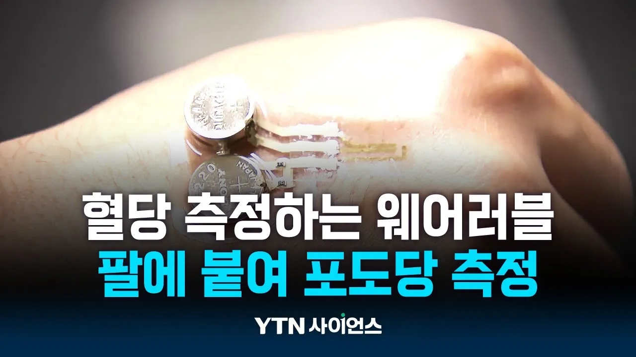 간편하게 팔에 붙여 포도당 측정...당뇨 관리 쉬워진다!