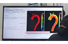 정밀 의료 속도장 예측모델(CV FLOW)/XR 플랫폼 기술/웨어러블 혈점도 예측 디바이스 이미지