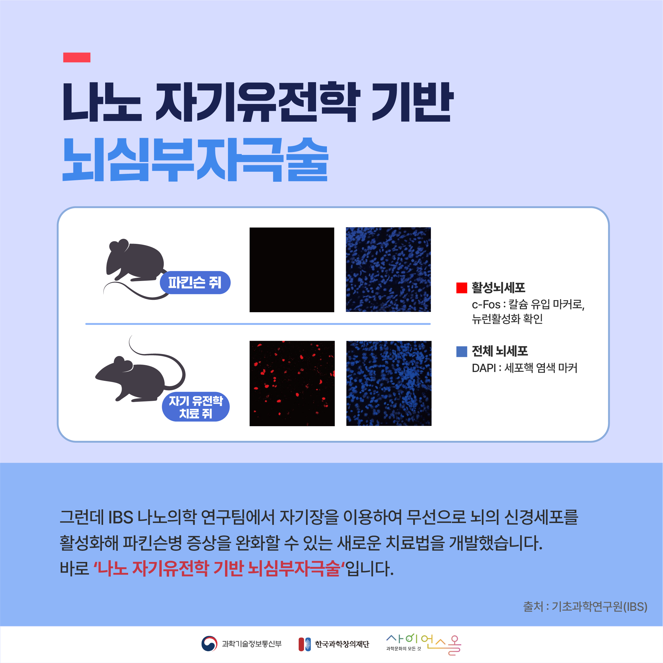 나노 자기유전학 기반 뇌심부자극술 활성뇌세포 c-Fos : 칼슘 유입 마커로, 뉴런활성화 확인 전체 뇌세포 DAPI : 세포핵 염색 마커 그런데 IBS 나노의학 연구팀에서 자기장을 이용하여 무선으로 뇌의 신경세포를 활성화해 파킨슨병 증상을 완화할 수 있는 새로운 치료법을 개발했습니다. 바로 나노자기유전학기반 뇌심부자극술입니다.