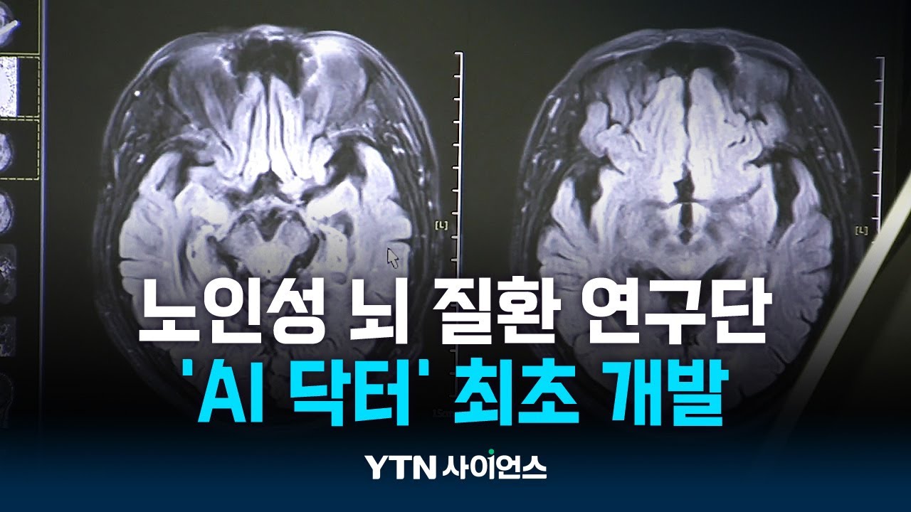 첫 노인성 뇌 질환 실증 연구단...임상 실증 플랫폼 구축!