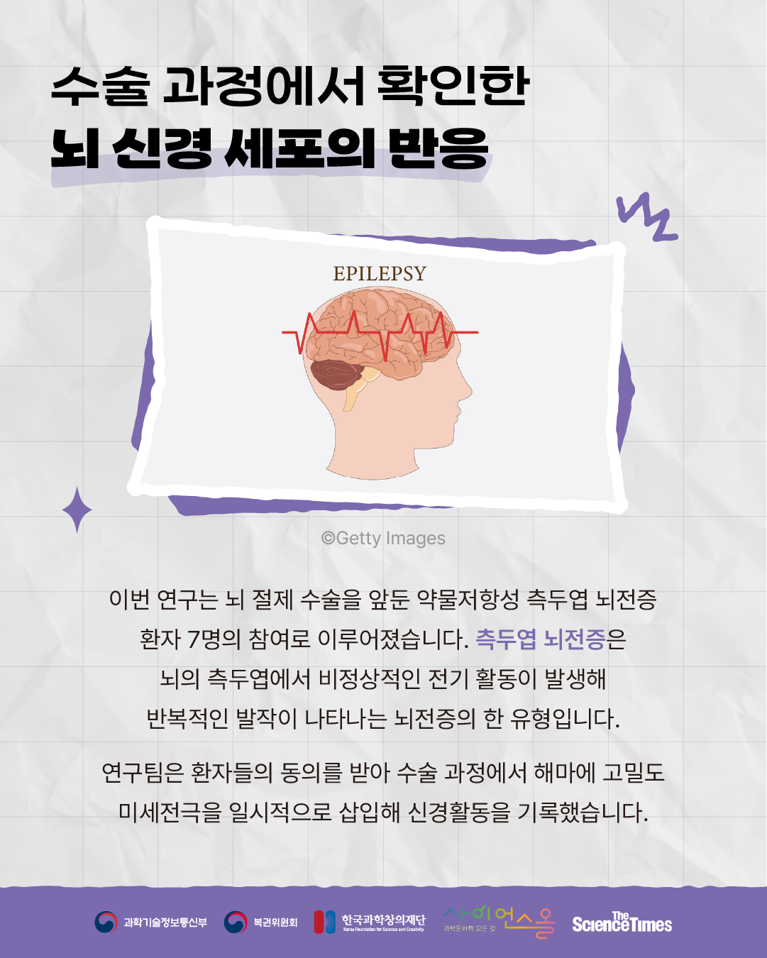 마취된 뇌 4