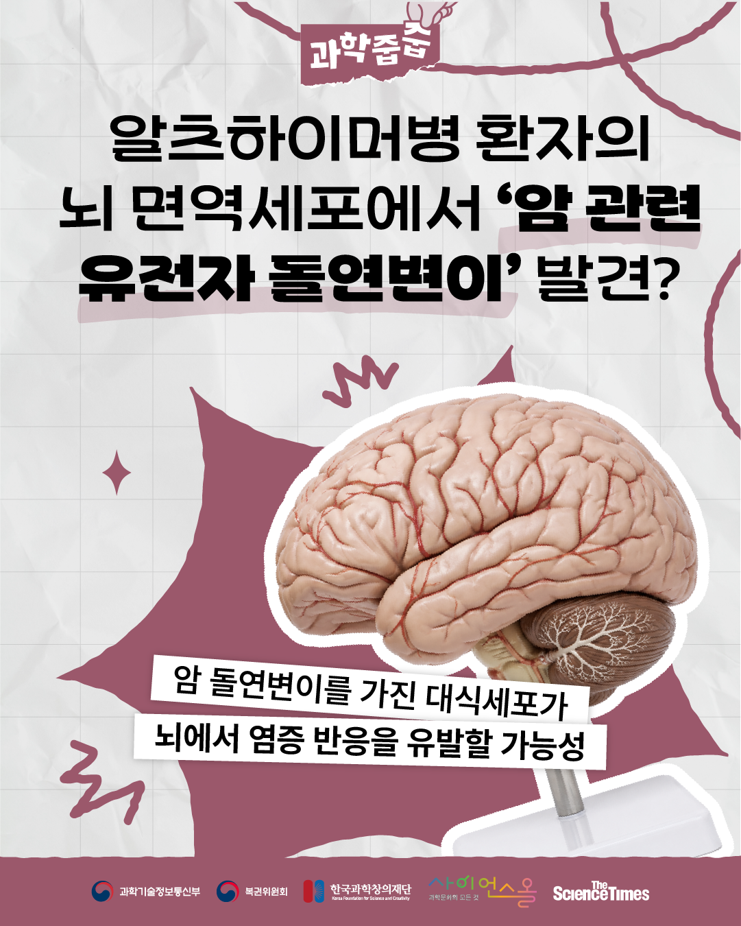 알츠하이머병 1