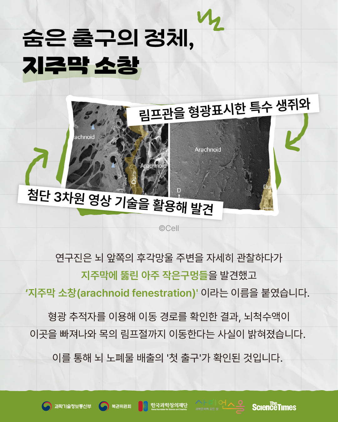 뇌 노폐물 4