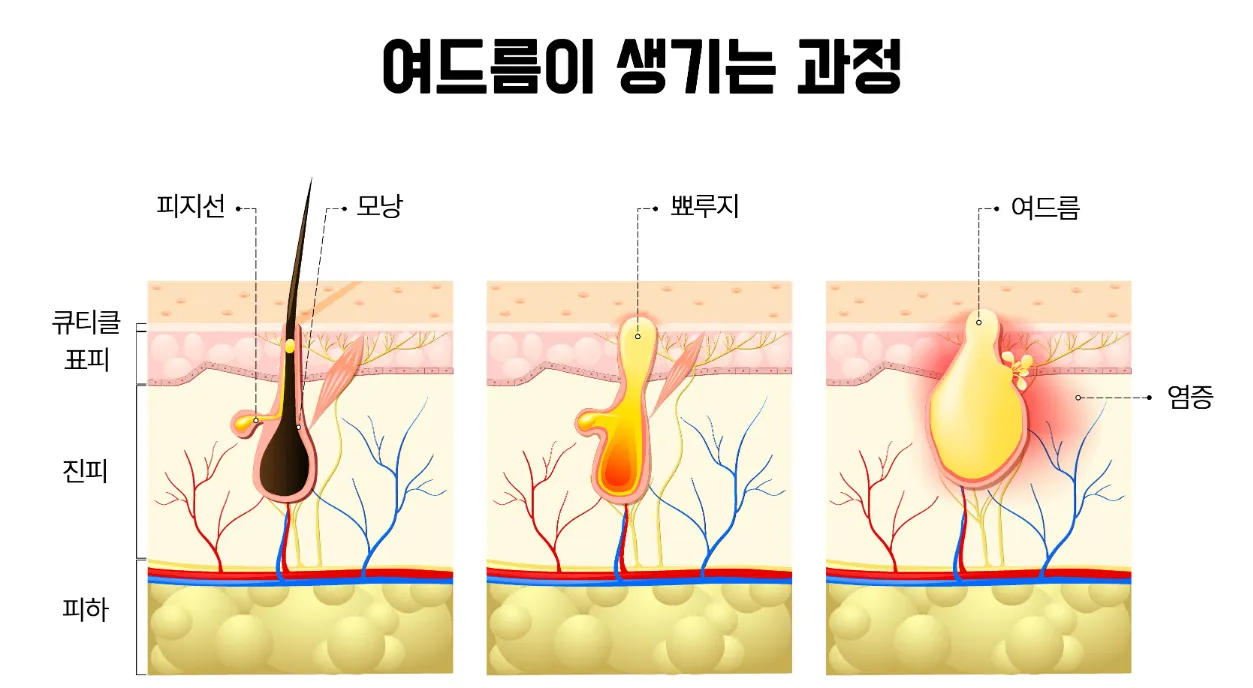 [과학향기 Story] 세균의 변신은 무죄? 미래 헬스케어 이끄는 ‘합성생물학’