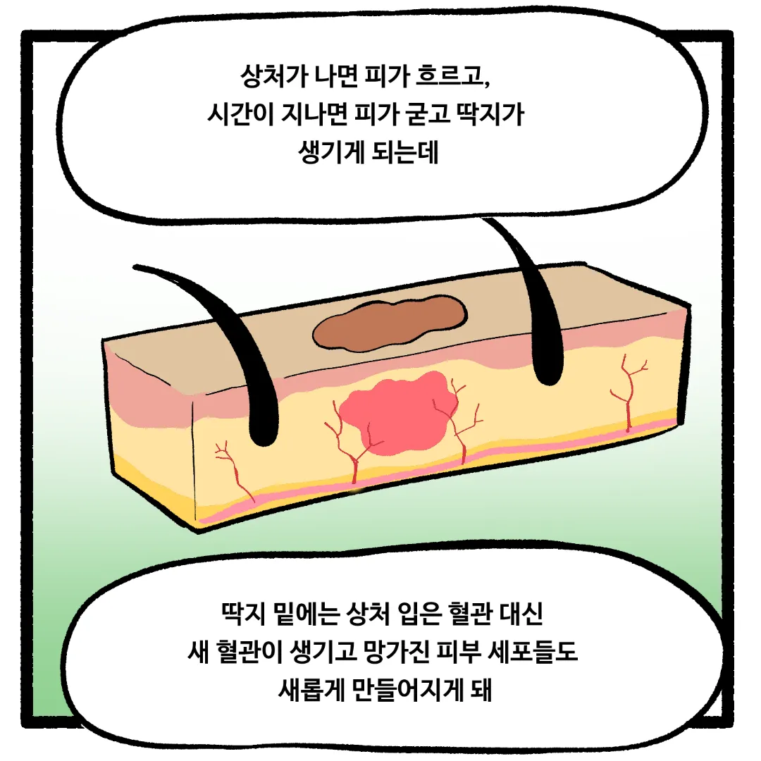 16화_상처가 아물면서 가려운 이유