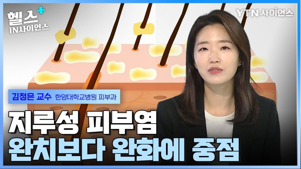 지루성 피부염, 세안 및 샴푸법은? _ 김정은 교수(한양대학교병원 피부과)