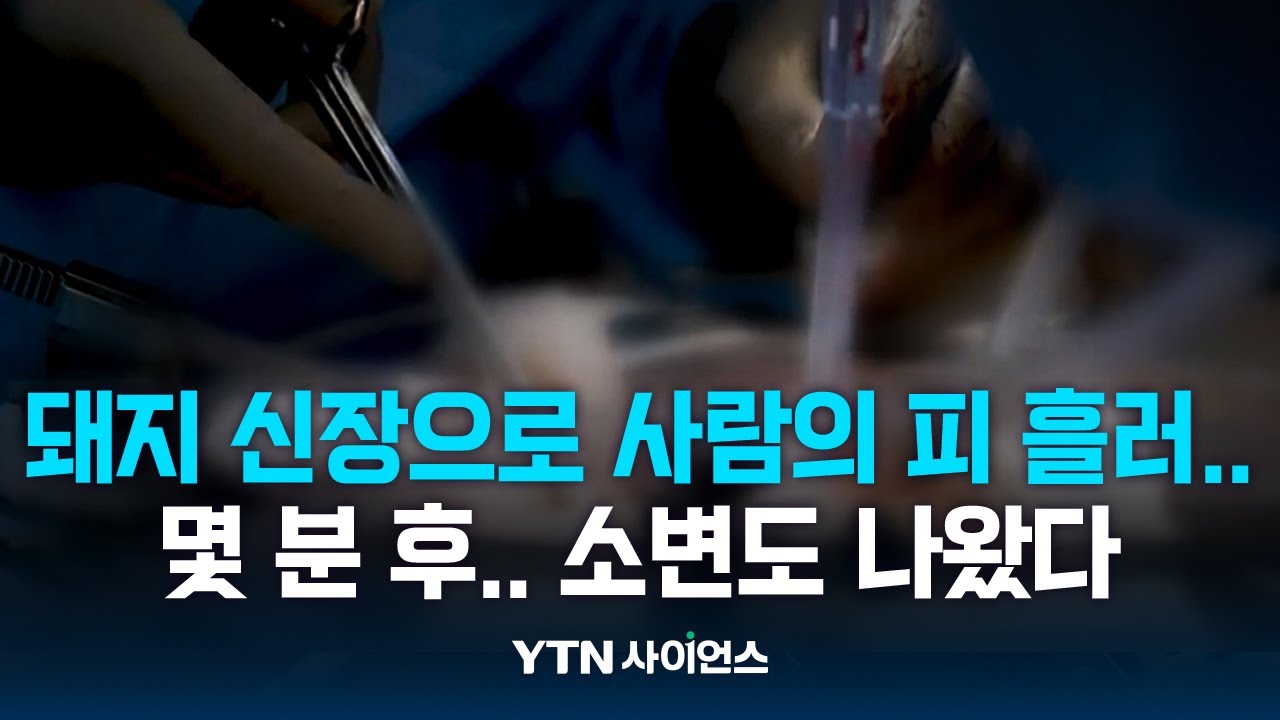 美, 뇌사자에 돼지신장 이식한 '이종이식' 사례.. 우리도 앞서간다 / 과학뉴스