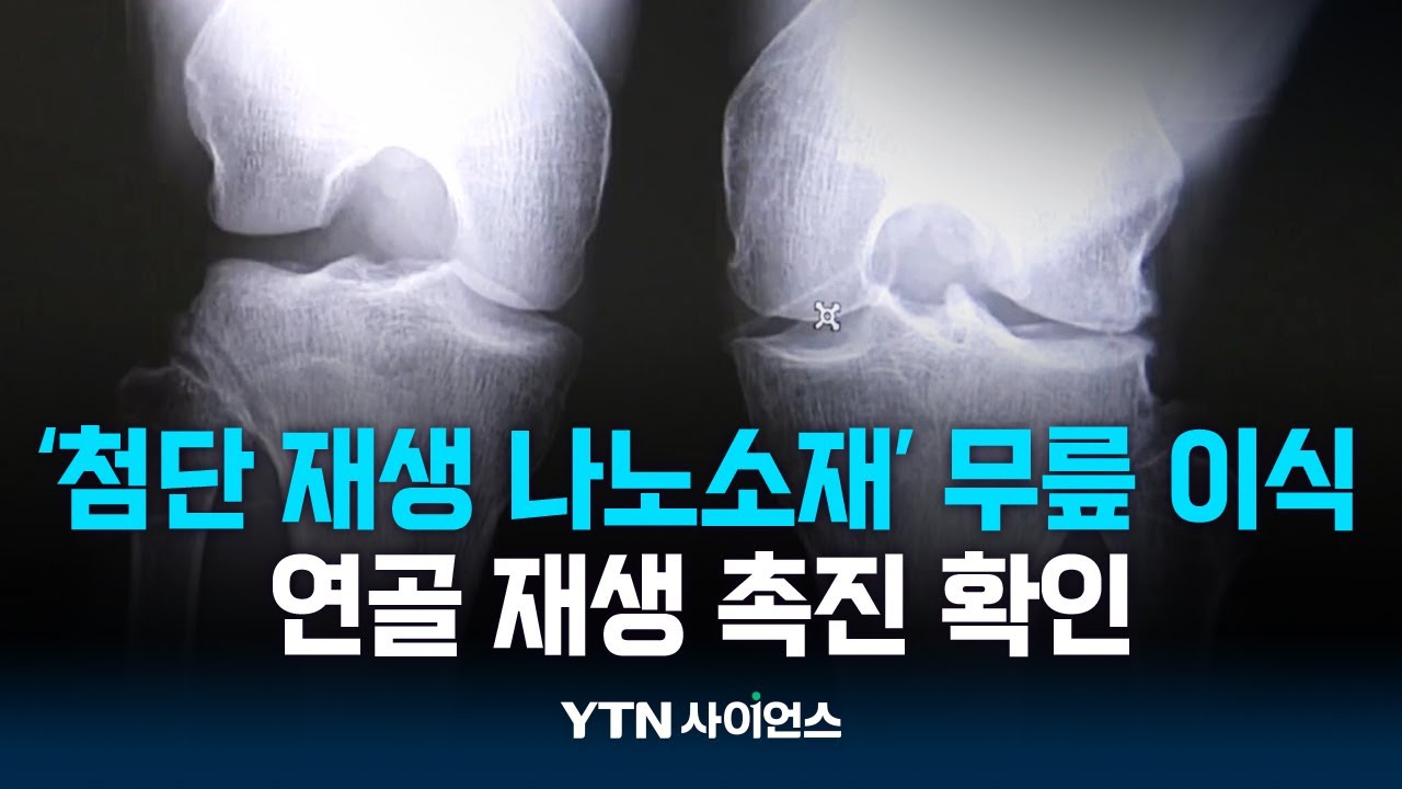 손상된 무릎 연골 치료하는 첨단 재생 나노소재 기술 개발