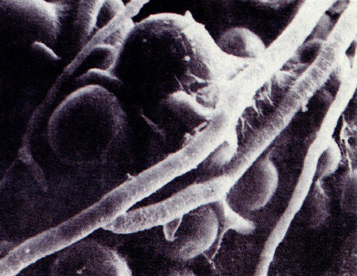 내생포자(endospore)