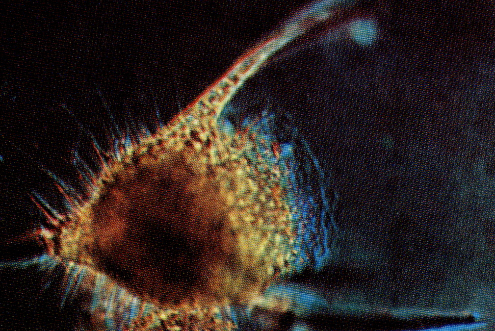 방산충(radiolarian)
