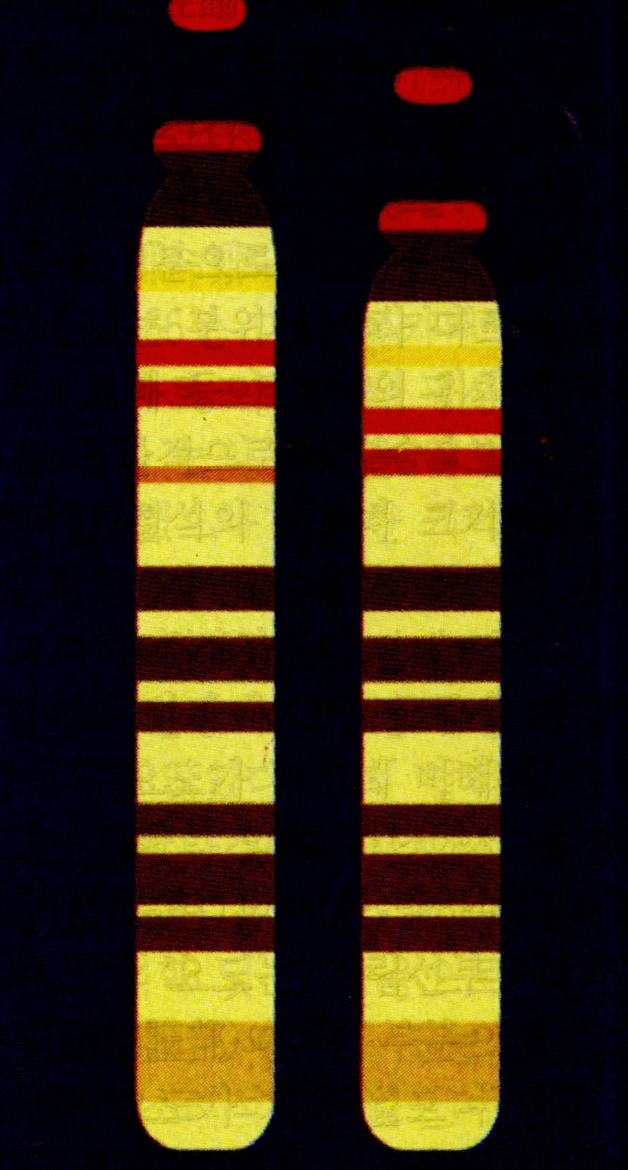 염색체이상(chromosomal aberration )