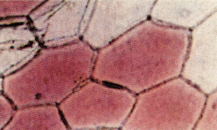 원형질분리(plasmolysis)
