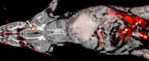 [사이언스타임즈] 온몸의 혈전, 한번 검사로 발견