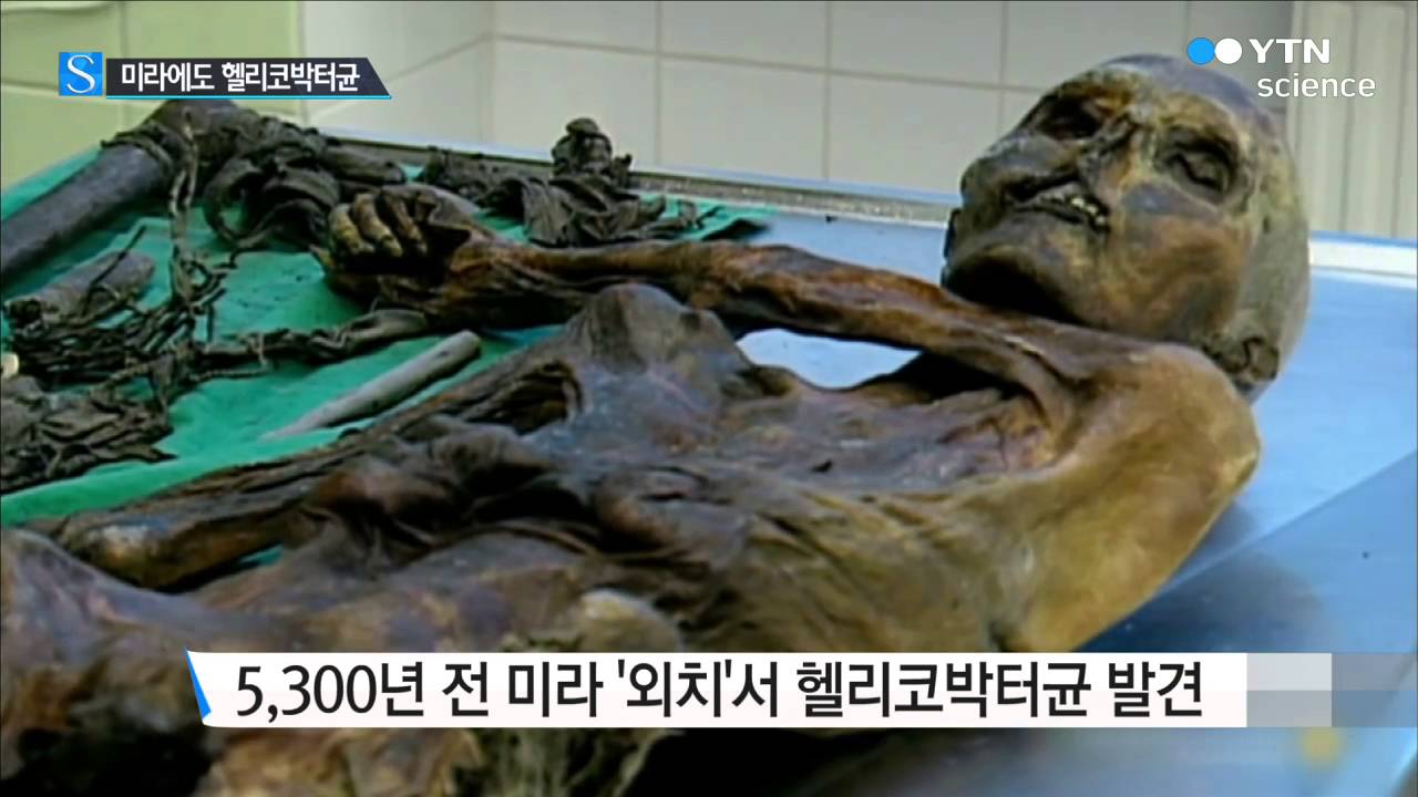 [사이언스 TV] 5,300년 전 유럽 미라에 헬리코박터균이...아시아인이 전파