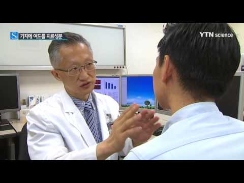 [사이언스 TV] '흉터 고민' 여드름, 가지에 치료제 성분