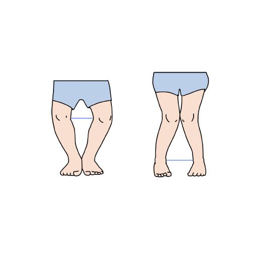 각기병