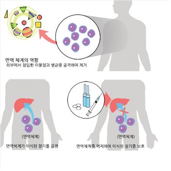 거부 반응