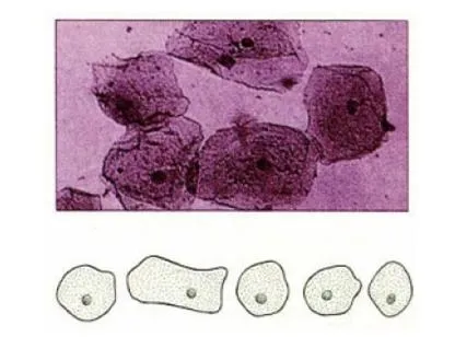 김사액(Giemsa solution)