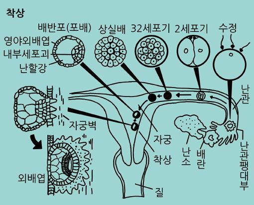 난할