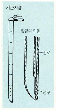기관지경