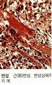 단백질 변성 (protein denaturation)