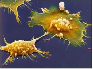 대식세포 (macrophage )大食細胞