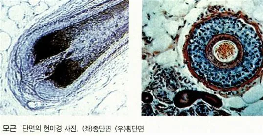 모근(hair root, 毛根)