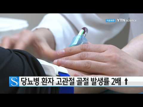 [사이언스 TV] 당뇨병 환자 고관절 골절 발생률 2배 ↑