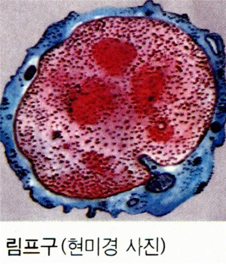 림프구