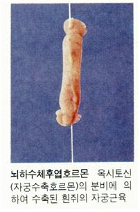 홀몬