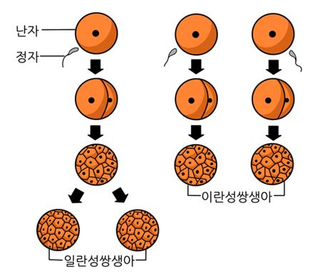 2란성