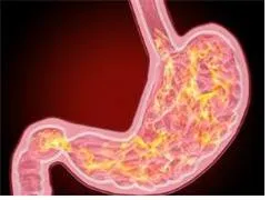 가스트린 (gastrin)