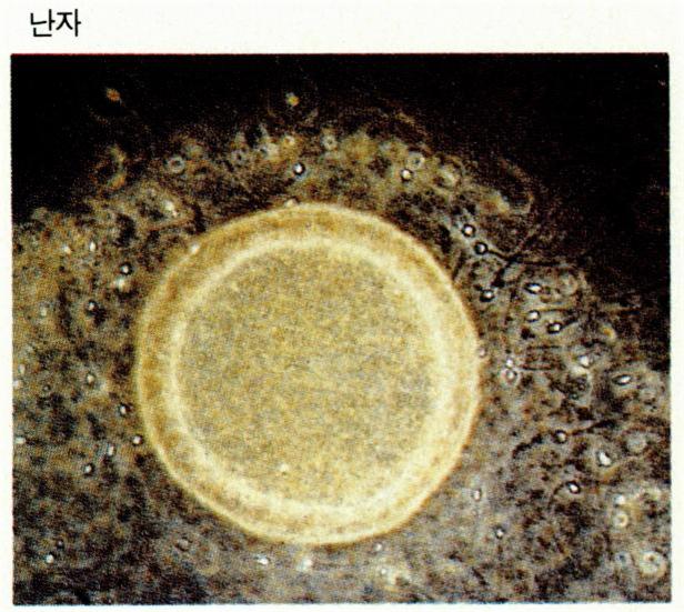 모세포