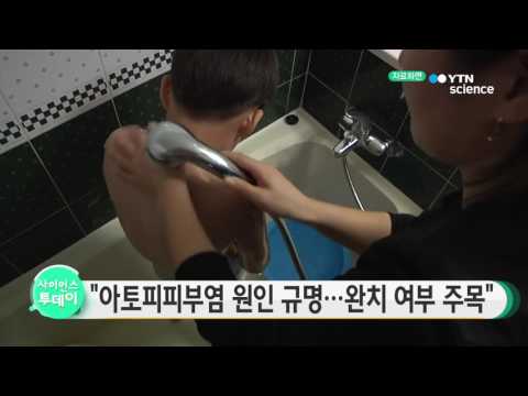 [사이언스 TV] 아토피피부염 근본원인 규명…완치법 개발 가능성 주목