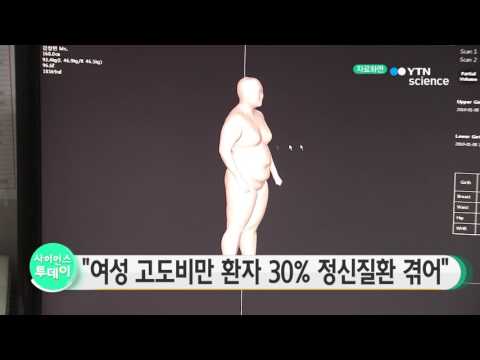 [사이언스 TV] 여성 고도비만 환자 30％는 정신질환 겪어