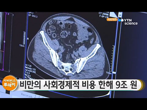 [사이언스TV] 비만의 사회경제적 비용 한해 9조 원...10년새 2배 늘어