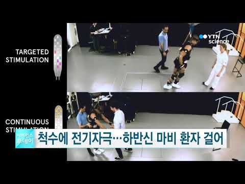 [사이언스TV] 척수에 전기자극 하반신 마비 환자 걸어