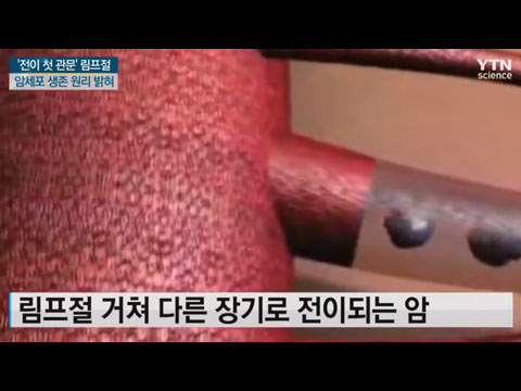 [사이언스TV] 전이 첫 관문 림프절에서 암세포 생존 원리 밝혀