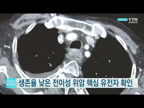 [사이언스TV] 생존율 낮은 전이성 위암 핵심 유전자 확인