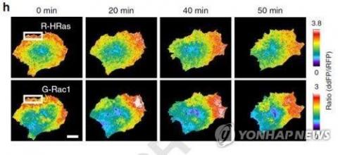 [사이언스타임즈] 뇌에 전이하는 유방암 원인 밝혀