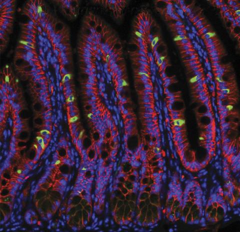 [사이언스타임즈] 솔세포 비밀 마침내 밝혀지다