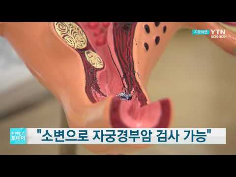 [사이언스TV] 자궁경부암 검사 쉬워질까, 소변으로 자궁경부암 검사 가능
