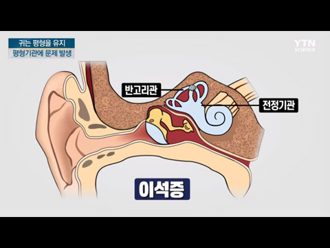 [사이언스TV] 세상이 빙글빙글, 어지럼증을 유발하는 귀 질환