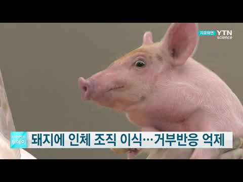 [사이언스TV] 돼지에 인체 조직 이식, 거부반응 억제 성공