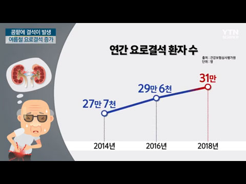 [사이언스TV] 내 몸속에 돌이  극심한 통증 유발하는 '요로결석'