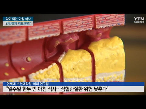 [사이언스TV] 약이 되는 아침 식사 건강하게 먹으려면