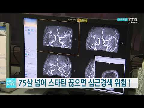 [사이언스TV] 75살 넘어 스타틴 끊으면 심근경색 위험↑