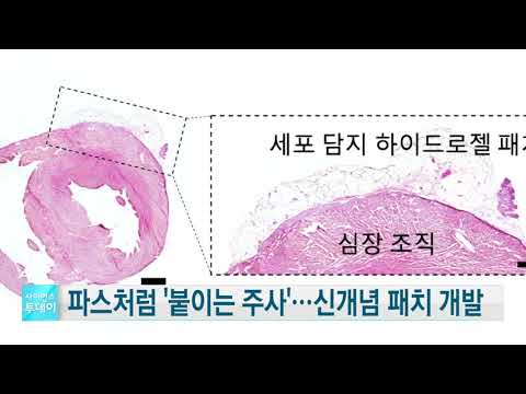 파스처럼 '붙이는 주사' 신개념 패치 개발