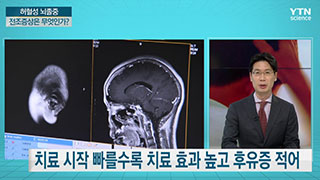 머릿속의 시한폭탄, 뇌경색