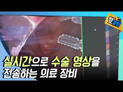 [핫클립] 인공지능으로 의료 동영상 데이터를 관리한다!
